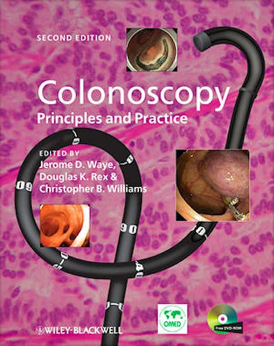 Portada del libro 9781405175999 Colonoscopy: Principles and Practice