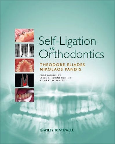 Portada del libro 9781405181907 Self-Ligation in Orthodontics
