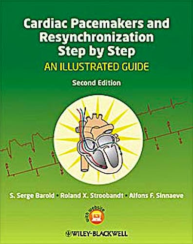 Portada del libro 9781405186360 Cardiac Pacemakers and Resynchronization Step by Step. an Illustrated Guide