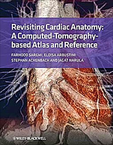 Portada del libro 9781405194693 Revisiting Cardiac Anatomy. a Computed-Tomography-Based Atlas and Reference