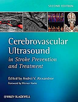 Portada del libro 9781405195768 Cerebrovascular Ultrasound in Stroke Prevention and Treatment