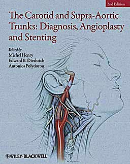 Portada del libro 9781405198547 The Carotid and Supra-Aortic Trunks: Diagnosis, Angioplasty and Stenting