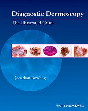 Portada del libro 9781405198554 Diagnostic Dermoscopy. the Illustrated Guide