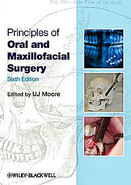 Portada del libro 9781405199988 Principles of Oral and Maxillofacial Surgery