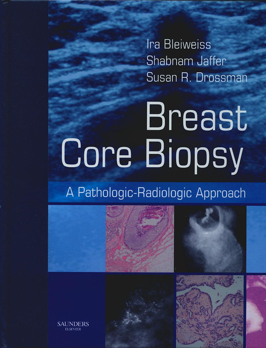 Portada del libro 9781416000266 Breast Core Biopsy