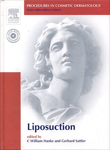 Portada del libro 9781416022084 Liposuction