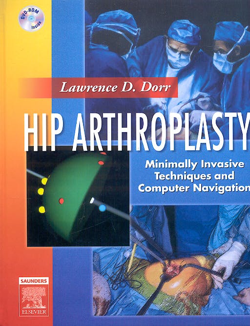 Portada del libro 9781416022978 Hip Arthroplasty + 2 Dvd´s