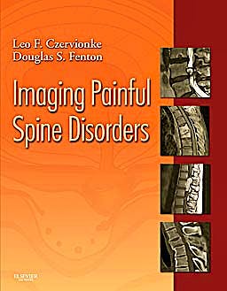 Portada del libro 9781416029045 Imaging Painful Spine Disorders (Online and Print)
