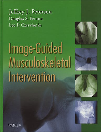 Portada del libro 9781416029052 Image-Guided Musculoskeletal Intervention