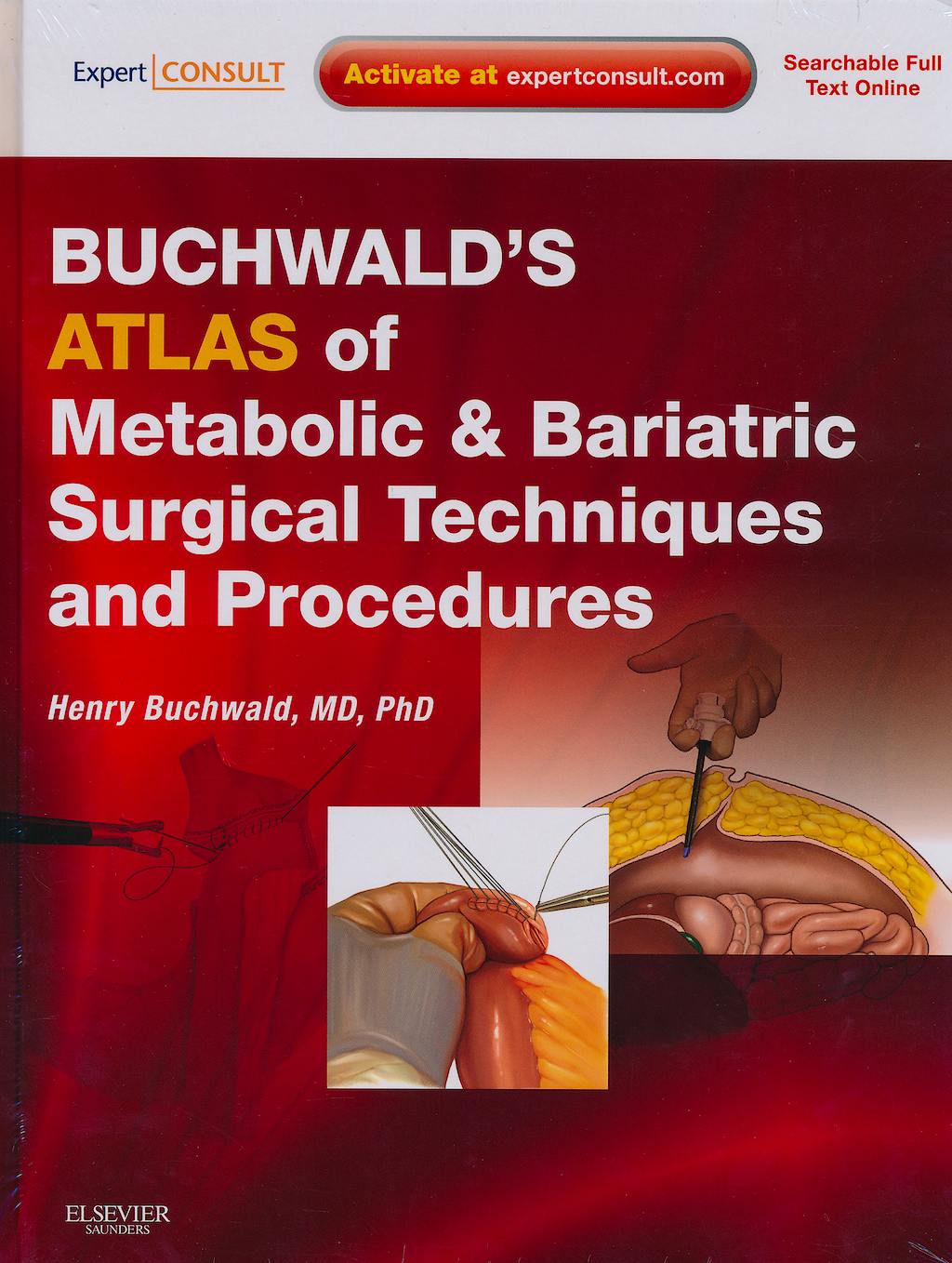 Portada del libro 9781416031062 Buchwald's Atlas of Metabolic and Bariatric Surgical Techniques and Procedures (Online and Print)