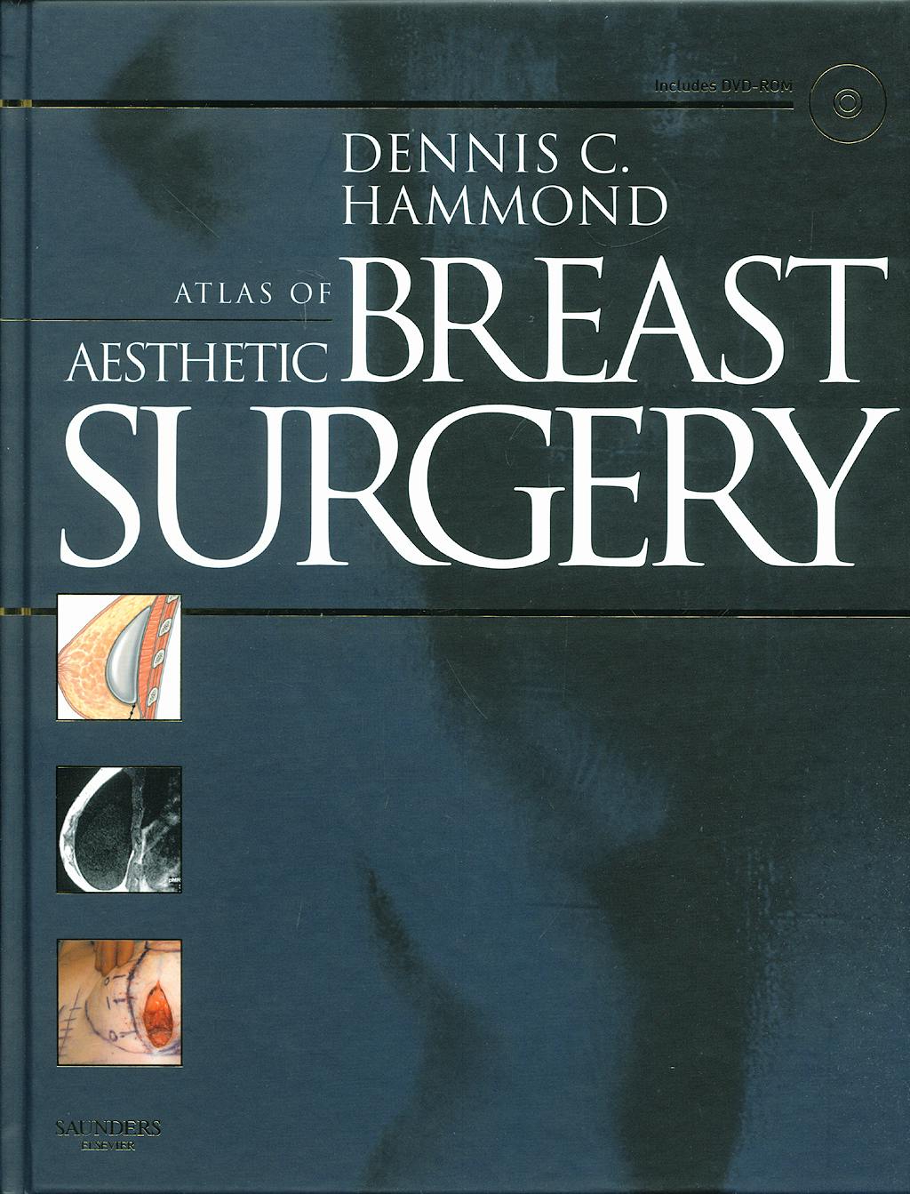 Portada del libro 9781416031840 Atlas of Aesthetic Breast Surgery + Dvd