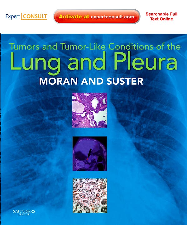 Portada del libro 9781416036241 Tumors and Tumor-like Conditions of the Lung and Pleura (Online and Print)