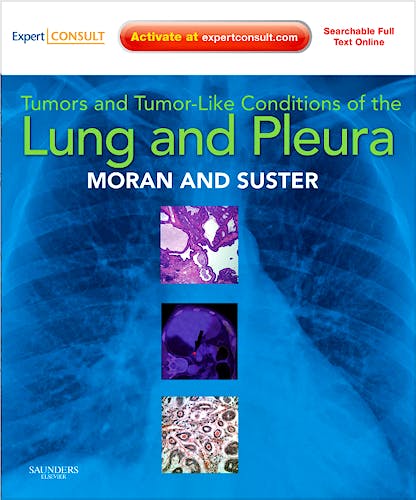 Portada del libro 9781416036241 Tumors and Tumor-like Conditions of the Lung and Pleura (Online and Print)