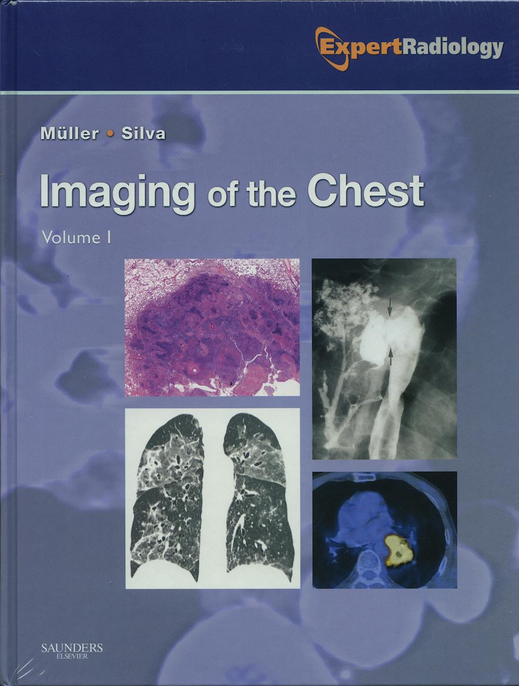 Portada del libro 9781416040484 Imaging of the Chest, 2 Vols.