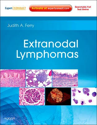 Portada del libro 9781416045793 Extranodal Lymphomas (Online and Print)