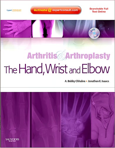 Portada del libro 9781416049715 Arthritis and Arthroplasty. the Hand, Wrist and Elbow