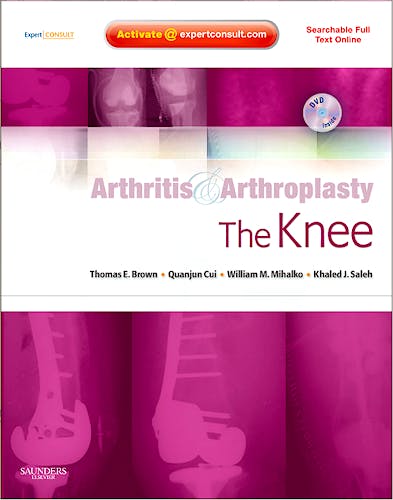 Portada del libro 9781416049746 Arthritis and Arthroplasty. the Knee (Searchable Full Text Online)