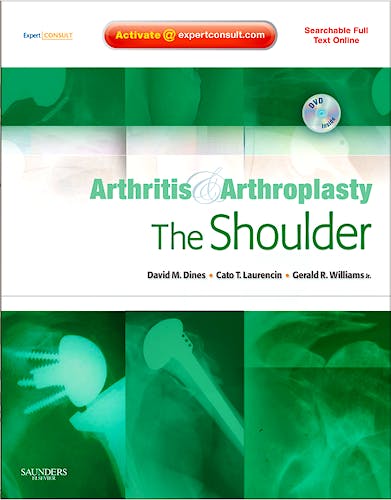 Portada del libro 9781416049753 Arthritis and Arthroplasty. the Shoulder (Searchable Full Text Online)