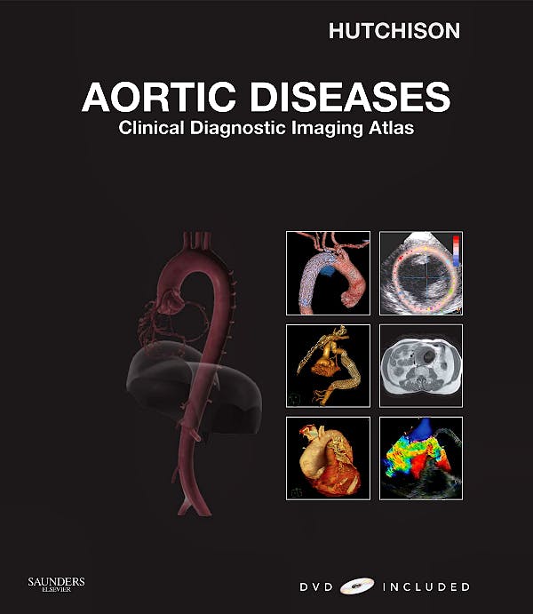 Portada del libro 9781416052708 Aortic Diseases. Clinical Diagnostic Imaging Atlas + Dvd