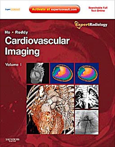 Portada del libro 9781416053354 Cardiovascular Imaging, 2 Volume Set (Online and Print)