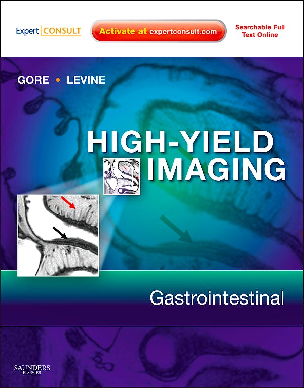 Portada del libro 9781416055440 High-Yield Imaging. Gastrointestinal