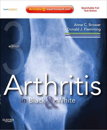 Portada del libro 9781416055952 Arthritis in Black and White