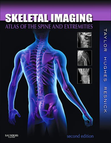 Portada del libro 9781416056232 Skeletal Imaging. Atlas of the Spine and Extremities
