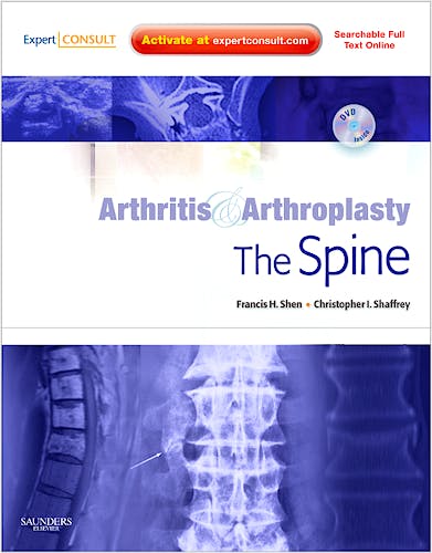 Portada del libro 9781416056430 Arthritis and Arthroplasty. the Spine