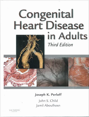 Portada del libro 9781416058946 Congenital Heart Disease in Adults