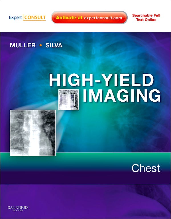 Portada del libro 9781416061618 High-Yield Imaging. Chest