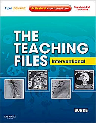 Portada del libro 9781416062608 The Teaching Files. Interventional