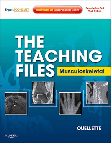 Portada del libro 9781416062615 The Teaching Files. Musculoskeletal