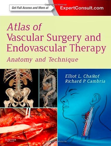 Portada del libro 9781416068419 Atlas of Vascular Surgery and Endovascular Therapy. Anatomy and Technique (Online and Print)