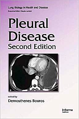 Portada del libro 9781420077384 Pleural Disease