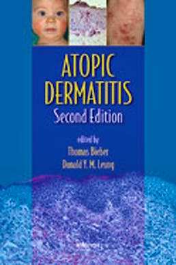 Portada del libro 9781420077988 Atopic Dermatitis