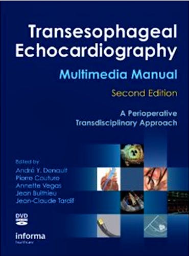 Portada del libro 9781420080704 Transesophageal Echocardiography. a Perioperative Transdisciplinary Approach