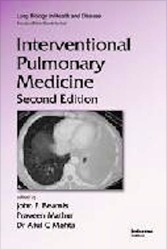 Portada del libro 9781420081848 Interventional Pulmonary Medicine