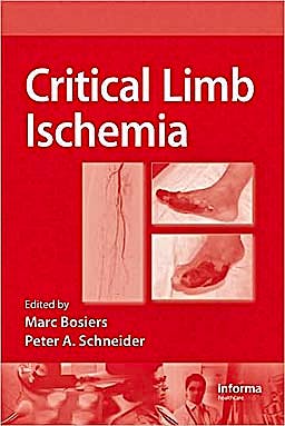 Portada del libro 9781420081893 Critical Limb Ischemia