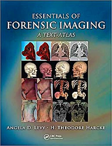 Portada del libro 9781420091113 Essentials of Forensic Imaging. a Text-Atlas