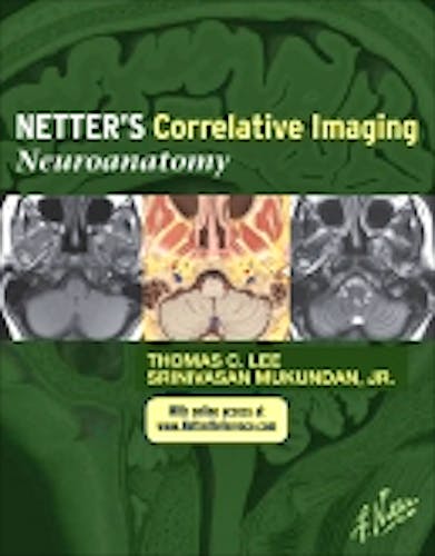 Portada del libro 9781437704150 Netter's Correlative Imaging. Neuroanatomy + Online Access