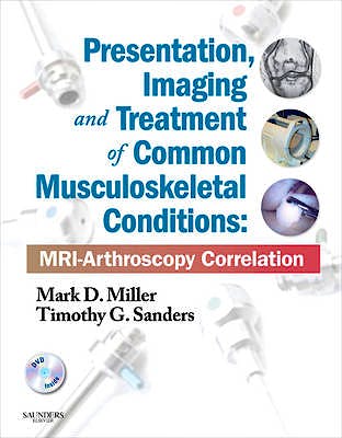Portada del libro 9781437709148 Presentation, Imaging and Treatment of Common Musculoskeletal Conditions: Mri-Arthroscopy Correlation (Online and Print)