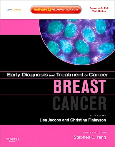 Portada del libro 9781437709674 Early Diagnosis and Treatment of Cancer Series: Breast Cancer, Colorectal Cancer, Head and Neck Cancers, Ovarian Cancer, and Prostate Cancer Package
