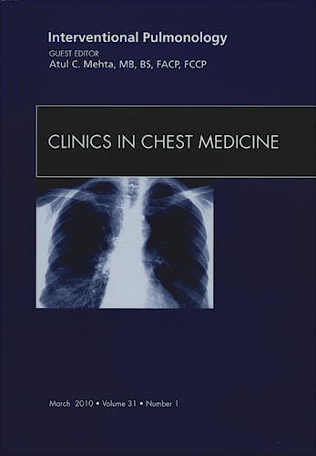 Portada del libro 9781437712025 Interventional Pulmonology, an Issue of Clinics in Chest Medicine, Vol. 31-1