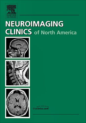 Portada del libro 9781437712421 Imaging of Movement Disorders, an Issue of Neuroimaging Clinics Volume 20-1