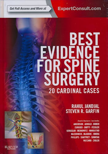 Portada del libro 9781437716252 Best Evidence for Spine Surgery. 20 Cardinal Cases (Online and Print)