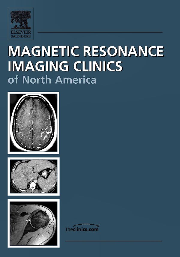 Portada del libro 9781437719253 Select Topics in Mr Imaging, an Issue of Magnetic Resonance Imaging Clinics Volume 18-1