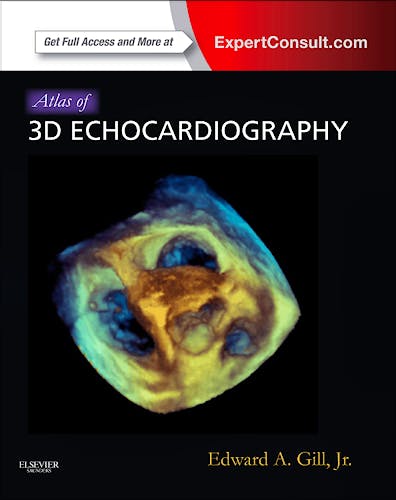 Portada del libro 9781437726992 Atlas of 3d Echocardiography (Online and Print)