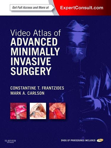 Portada del libro 9781437727234 Video Atlas of Advanced Minimally Invasive Surgery (Online and Print)