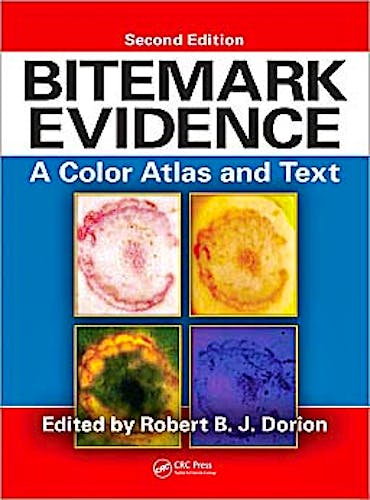 Portada del libro 9781439818626 Bitemark Evidence. a Color Atlas and Text