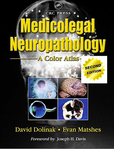 Portada del libro 9781439861530 Medicolegal Neuropathology. A Color Atlas